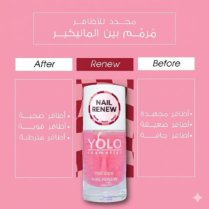 نيل رينيو